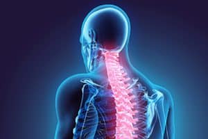 Spine injury after car accident